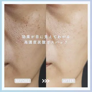 Rifuro毛穴ケア &よもぎ蒸しサロンの眉毛・アイブロウイメージ