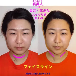 筋膜整体＆小顔矯正 　姿美人.シルエットのエステ・リラクイメージ