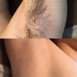 YES脱毛サロン　大阪京橋店所属・メンズ脱毛サロン YESのエステ・リラクイメージ