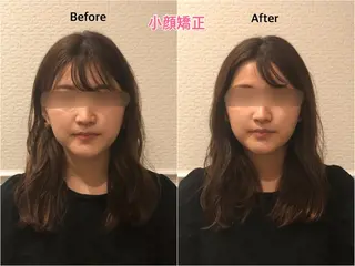 チキバン美容鍼灸整体 サロン心斎橋店のエステ・リラクイメージ