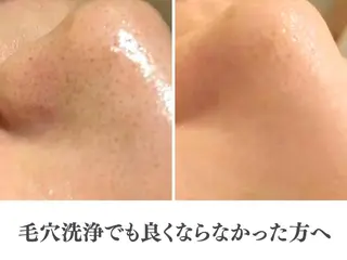 夏までに肌荒れ卒業 するサロン🌻のエステ・リラクイメージ