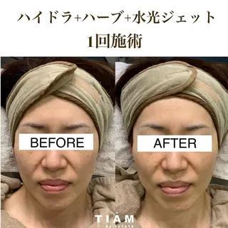 美肌サロンTIAM by tetoteのエステ・リラクイメージ