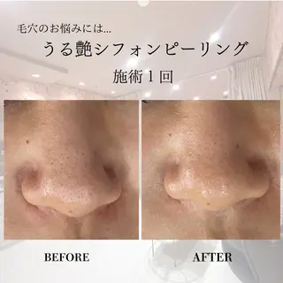 肌質改善専門サロン Bellmi/心斎橋のエステ・リラクイメージ