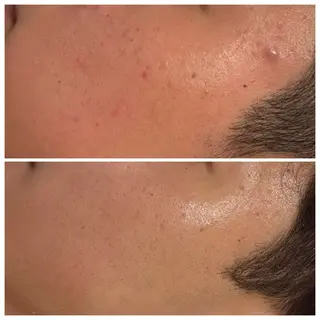 通うほど変わる本格 エステ心斎橋REVIのエステ・リラクイメージ