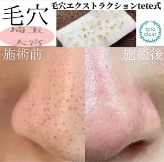 private salon  Dea_maris シュガーリング＆パーソナルボディケア所属・シミ改善・韓国肌管理 ボディメイク痩身のその他イメージ