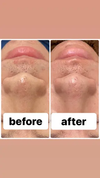 A/S アズのエステ・リラクイメージ