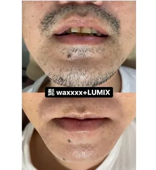 Epina 千葉店 【エピナ】のエステ・リラクイメージ