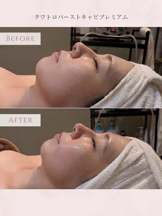 total beauty HAPPY所属・O. Minaのその他イメージ