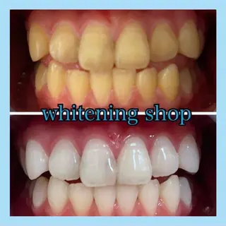 ホワイトニング ショップ千葉店のその他イメージ