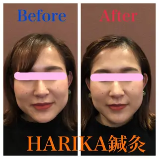 HARIKA鍼灸所属・HARIKA 鍼灸のその他イメージ