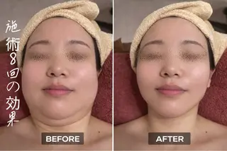 【歴13年】劇的小顔 D rマジックタッチのエステ・リラクイメージ