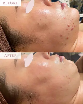 肌質改善サロン LesFleursのエステ・リラクイメージ