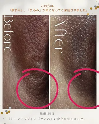 KUGO　SALON yukina ユキナのエステ・リラクイメージ