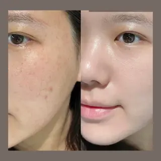 愛維美水光美肌専門店所属・愛維美水光美肌専門店 メンズレディースokのエステ・リラクイメージ