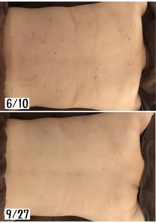 ミディアム カラー パーマ ヘアアレンジ メンズ キッズ ネイル マツエク・マツパ ニキビ・肌質改善専門 ♡人生が変わるサロンのエステ・リラクイメージ