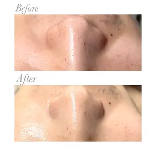 NAYU/レディース 眉毛/堺筋本町の眉毛・アイブロウイメージ