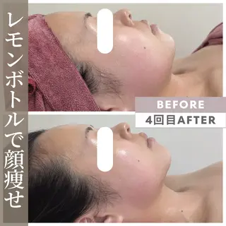小顔矯正専門店 【RED】池田のエステ・リラクイメージ