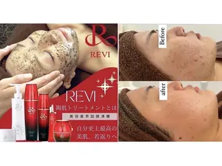 ハーブピーリング/韓国肌管理/フェイシャル/毛穴洗浄/眉毛/顔脱毛【糸脱毛専門】rev所属・ハーブピーリング🌹 毛穴洗浄❤️眉waxのエステ・リラクイメージ