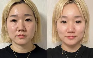 耳ツボ/体質改善/ 温活La mer月島のその他イメージ