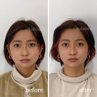 はり灸サロン　totonoi所属・印象の良くなる 美容鍼のエステ・リラクイメージ