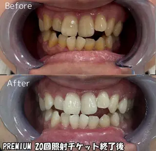 凛 リンのネイルデザイン