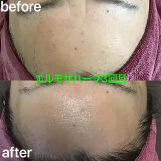 氣楽所属・松下 さゆりのエステ・リラクイメージ