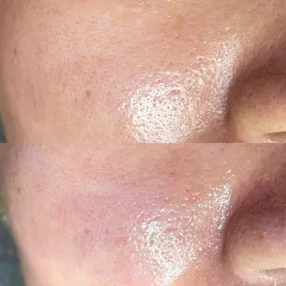 毛穴専門店MeMe.八千代店所属・\毛穴・頭皮/ のお悩みに特化💪のその他イメージ