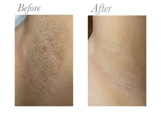 NAYU/レディース 眉毛/堺筋本町の眉毛・アイブロウイメージ