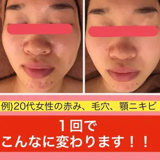 ミディアム カラー パーマ ヘアアレンジ メンズ キッズ ネイル マツエク・マツパ ニキビ・肌質改善専門 ♡人生が変わるサロンのエステ・リラクイメージ