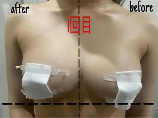 毛穴洗浄・痩身・脱毛 /アルカンジュのエステ・リラクイメージ