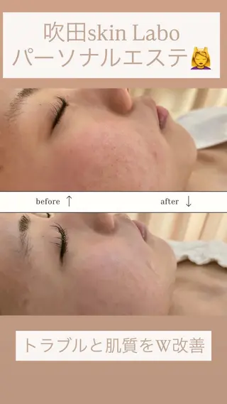 skinLabo所属・saya Mのエステ・リラクイメージ