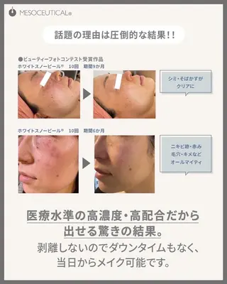 RinRin 豊田店のエステ・リラクイメージ