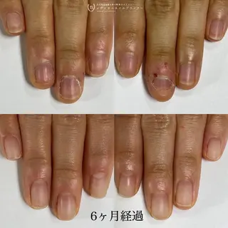 ネイル tsuki elfのエステ・リラクイメージ