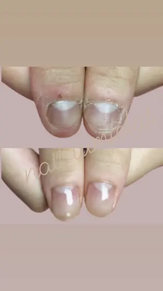 ネイル 深爪育成専門nail _Lumièlatのネイルデザイン