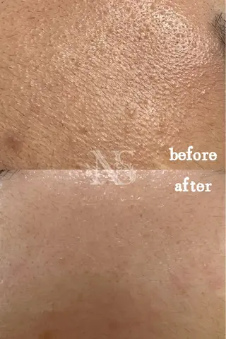 Nature Souce毛穴専門店のその他イメージ