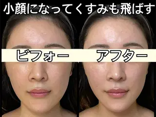 小顔専門看護師クリニカルサロンCOCO所属・小顔と美肌サロン クリニカルサロンココのエステ・リラクイメージ