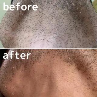 美肌脱毛&光フェイシャルサロン　ギュネシ所属・脱毛&光フェイシャル サロン　ギュネシのエステ・リラクイメージ