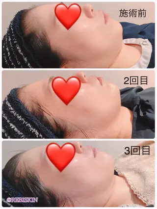 【痩身・脱毛サロン】 REBISKIN🌱のエステ・リラクイメージ