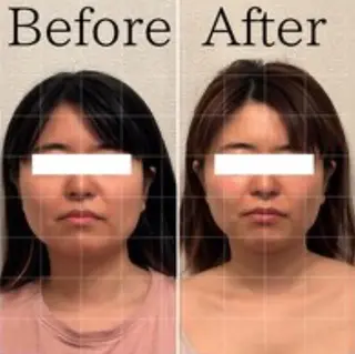 Lily luce 美骨小顔矯正のその他イメージ