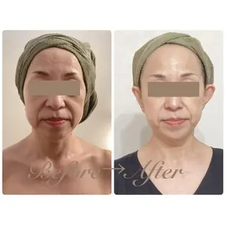 痩身脱毛専門店 Partirのエステ・リラクイメージ