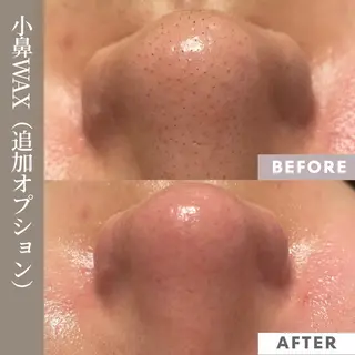 【フェムケア専門店】 PEQLIAヒロミのエステ・リラクイメージ