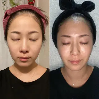 Meetite 小林のエステ・リラクイメージ