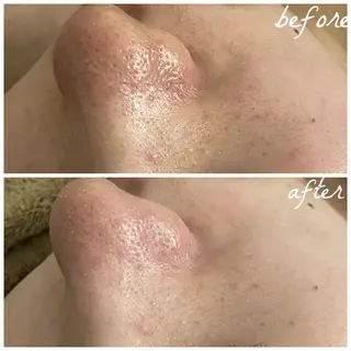 メンズ メナード岐阜茜部 杉浦のエステ・リラクイメージ