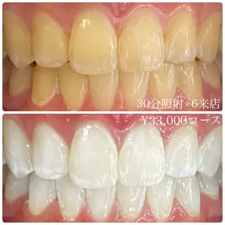 メンズ ホワイトニングルーム　川崎店所属・ホワイトニング ルーム　川崎店のその他イメージ