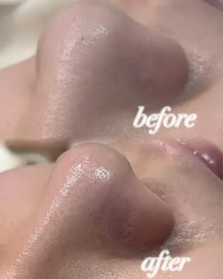 ぷる艶肌🫧 shaving斉藤のその他イメージ