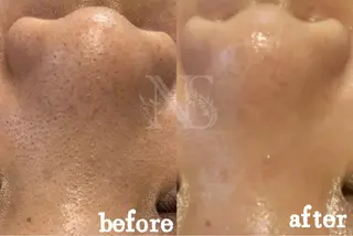 Nature Souce毛穴専門店のその他イメージ