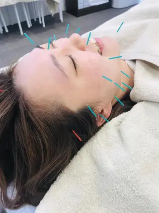 ヒロスポーツ 鍼灸整骨院のエステ・リラクイメージ