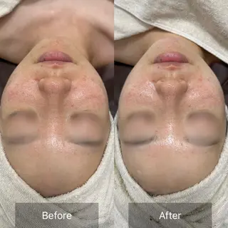 Nicore所属・Nicore NATSUKIのエステ・リラクイメージ