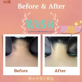 WISH 美肌脱毛のプロ！須藤のエステ・リラクイメージ