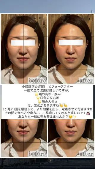 💎後悔させない小顔 矯正💎イトヤマ🌱のエステ・リラクイメージ